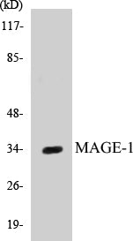 Western blot analysis of extracts from HepG2 cells, using MAGE-1 Antibody.