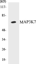 Western blot analysis of extracts from K562 cells/HepG2 cells, using MAP3K7 (Ab-439) Antibody.