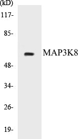 Western blot analysis of extracts from COLO205 cells, treated with Insulin 0.01U/ml 15', using MAP3K8 (Ab-400) Antibody.