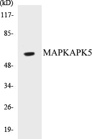 Western blot analysis of extracts from MCF-7 cells, using MAPKAPK5 (Ab-182) Antibody.