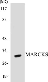 Western blot analysis of extracts from Jurkat cells, using MARCKS (Ab-158) Antibody.