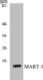 Western blot analysis of extracts from NIH-3T3 cells, using MART-1 Antibody.