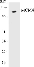 Western blot analysis of extracts from NIH-3T3/K562 cells, using MCM4 (Ab-54) Antibody.