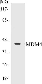 Western blot analysis of extracts from rat muscle cells, using MDM4 (Ab-367) Antibody.
