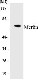 Western blot analysis of extracts from RAW264.7 cells, using Merlin (Ab-10) Antibody.