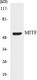 Western blot analysis of extracts from HepG2 cells, using MITF (Ab-180/73) Antibody.