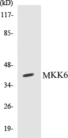 Western blot analysis of extracts from MDA-MB-435 cells, using MKK6 (Ab-207) Antibody.