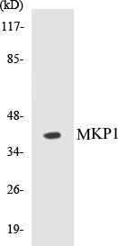 Western blot analysis of extracts from Jurkat cells, using MKP1 (Ab-359) Antibody.