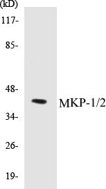 Western blot analysis of extracts from Jurkat cells, using MKP-1/2 (Ab-296/318) Antibody.