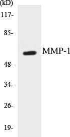 Western blot analysis of extracts from HepG2 cells, using MMP-1 Antibody.