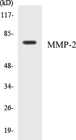 Western blot analysis of extracts from HT-29 cells, using MMP-2 Antibody.