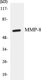 Western blot analysis of extracts from NIH-3T3 cells, using MMP-8 Antibody.