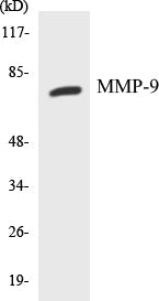 Western blot analysis of extracts from HepG2 cells, using MMP-9 Antibody.