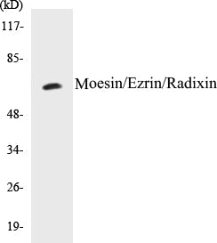 Western blot analysis of extracts from NIH-3T3 cells, using Moesin/Ezrin/Radixin (Ab-558) Antibody.