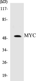 Western blot analysis of extracts from HeLa cells, treated with Forskolin 40nM 30', using MYC (Ab-62) Antibody.