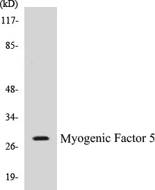 Western blot analysis of extracts from COS7 cells, using MYF5 (Ab-49) Antibody.