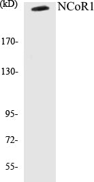 Western blot analysis of extracts from MDA-MB-435 cells, using NCoR1 Antibody.