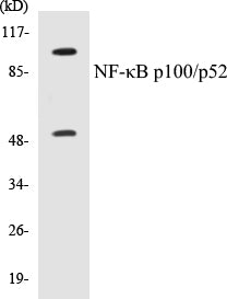 Western blot analysis of extracts from ovary cancer cells, using NF-kappaB p100/p52 (Ab-865) Antibody.