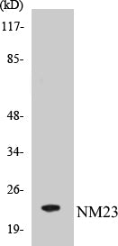 Western blot analysis of extracts from K562 cells, using NM23 Antibody.