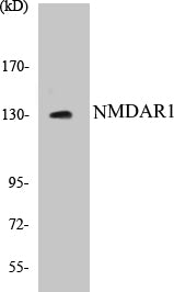 Western blot analysis of extracts from Jurkat cells, using NMDAR1 (Ab-890) Antibody.