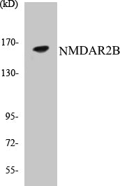 Western blot analysis of extracts from Jurkat cells, using NMDAR2B (Ab-1474) Antibody.