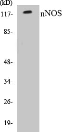 Western blot analysis of extracts from Raw264.7 cells, treated with INF 2500u/ml 10', using nNOS (Ab-852) Antibody.