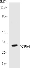 Western blot analysis of extracts from Jurkat cells, using NPM (Ab-199) Antibody.