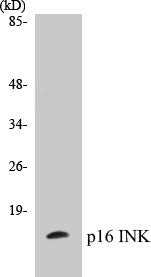 Western blot analysis of extracts from HeLa cells, using p16 INK Antibody.