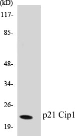 Western blot analysis of extracts from COLO/K562 cells, treated with EGF, using p21 Cip1 (Ab-145) Antibody.