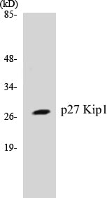 Western blot analysis of extracts from A2780 cells, using p27 Kip1 (Ab-10) Antibody.