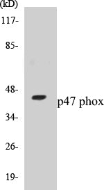 Western blot analysis of extracts from HT-29/COLO205/HepG2 cells, , using p47 phox (Ab-370) Antibody.