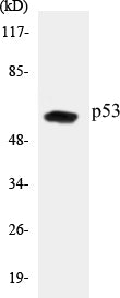 Western blot analysis of extracts from COS7 cells, treated with UV 5', using p53 (Ab-20) Antibody.