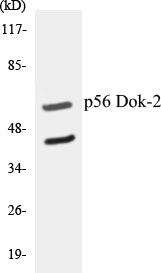 Western blot analysis of extracts from COLO205, using p56 Dok-2 (Ab-299) Antibody.