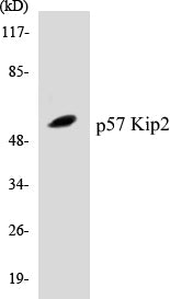 Western blot analysis of extracts from K562 cells, using p57 Kip2 (Ab-310) Antibody.
