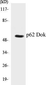 Western blot analysis of extracts from Jurkat cells, using p62 Dok (Ab-362) Antibody.