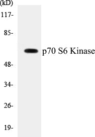 Western blot analysis of extracts from HeLa/HepG2, using p70 S6 Kinase (Ab-371) Antibody.
