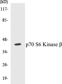 Western blot analysis of extracts from 293 cells, using p70 S6 Kinase beta (Ab-423) Antibody.