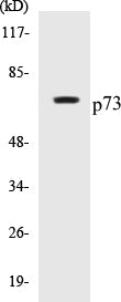 Western blot analysis of extracts from K562 cells, using p73 (Ab-99) Antibody.
