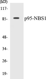 Western blot analysis of extracts from Jurkat cells, using p95/NBS1 (Ab-343) Antibody.