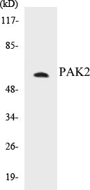Western blot analysis of extracts from HeLa cells, treated with TSA 400nM 24H, using PAK2 (Ab-141) Antibody.