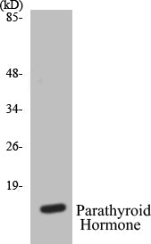 Western blot analysis of extracts from A549 cells, using Parathyroid Hormone Antibody.