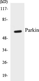 Western blot analysis of extracts from HeLa/HuvEc cells, using Parkin (Ab-131) Antibody.