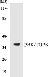Western blot analysis of extracts from COS7 cells, treated with Nocodazole 1ug/ml 16h, using PBK/TOPK (Ab-9) Antibody.
