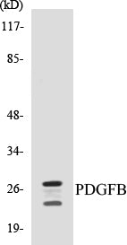 Western blot analysis of extracts from NIH-3T3 cells, using PDGFB Antibody.