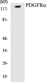 Western blot analysis of extracts from HepG2 cells, using PDGFR alpha Antibody.