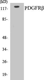 Western blot analysis of extracts from LOVO cells, treated with H2O2 100uM 30', using PDGFR beta (Ab-1021) Antibody.