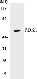Western blot analysis of extracts from MDA-MB-435 cells, treated with EGF, using PDK1 (Ab-241) Antibody.
