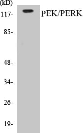 Western blot analysis of extracts from MCF-7 cells, using PEK/PERK (Ab-981) Antibody.