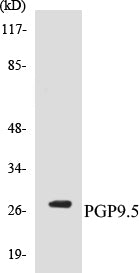 Western blot analysis of extracts from 293 cells, using PGP9.5 Antibody.