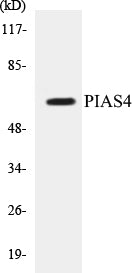 Western blot analysis of extracts from Jurkat cells, using PIAS4 Antibody.